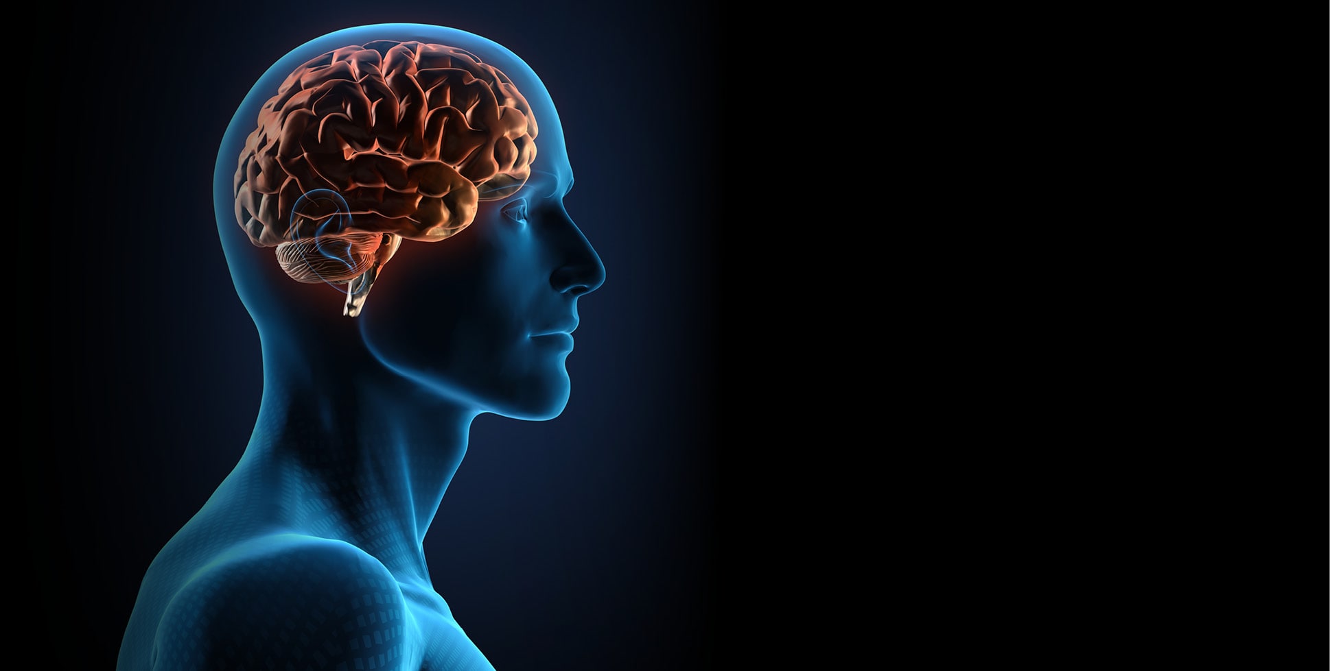 Physiotherapy management of Parkinson’s disease