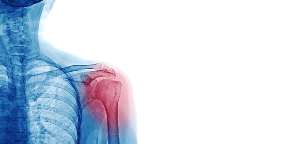 Simplifying the complex