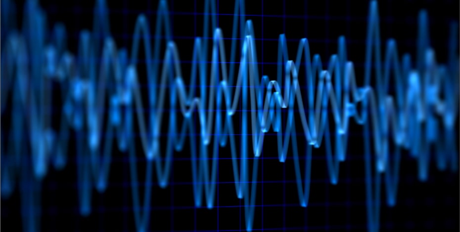 Neuromuscular electrical stimulation during haemodialysis
