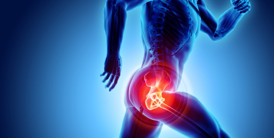 Researching the running mechanics in people with hip-related pain